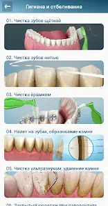 Стоматология - 3D иллюстрации - скриншот 2