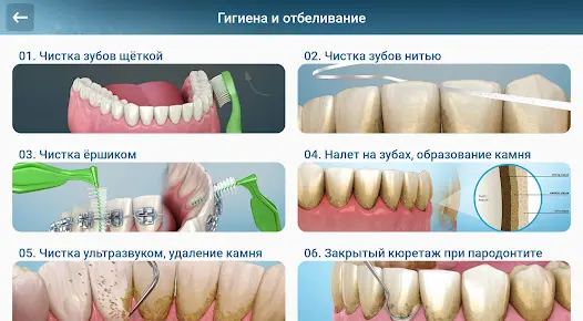 Стоматология - 3D иллюстрации - скриншот 10