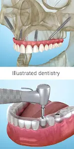 Стоматология - 3D иллюстрации - скриншот 4