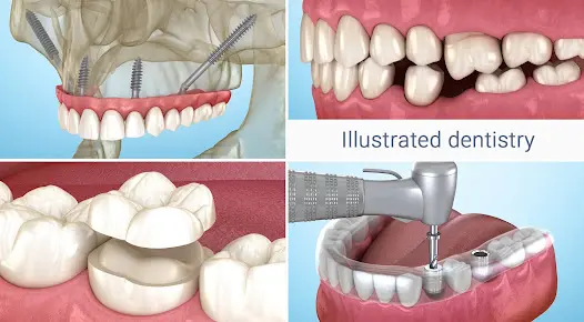 Стоматология - 3D иллюстрации - скриншот 11