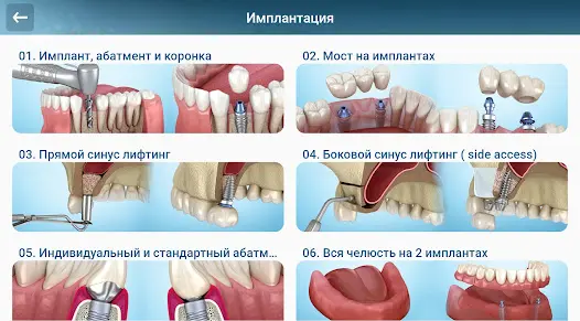 Стоматология - 3D иллюстрации - скриншот 8